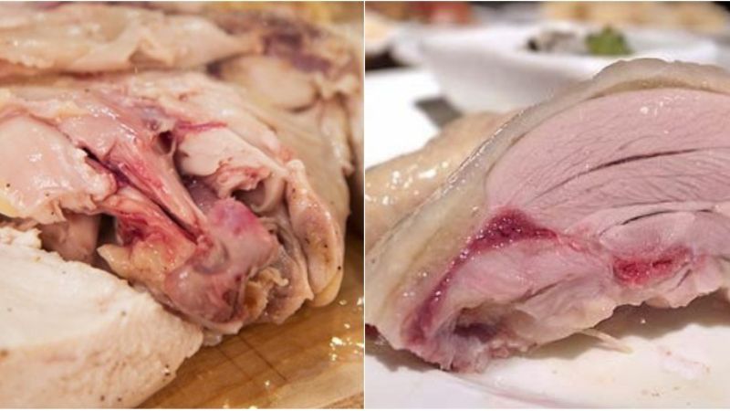 Nguyên nhân nhiễm vi khuẩn campylobacter và cách phòng ngừa 3