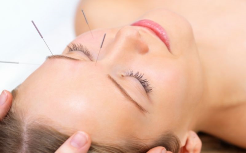 Cách chữa sụp mí mắt bằng Đông y có hiệu quả không? 4