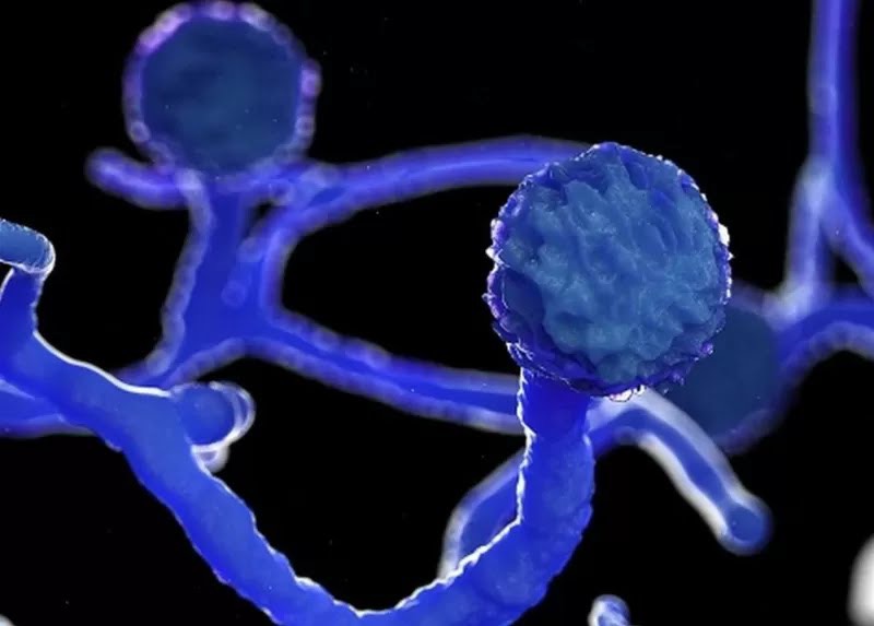 Nhận biết bệnh nấm đen và cách chữa trị phù hợp