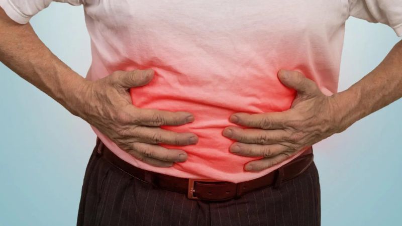 Nhận biết dấu hiệu có khối u ở bụng và biến chứng thường gặp 2