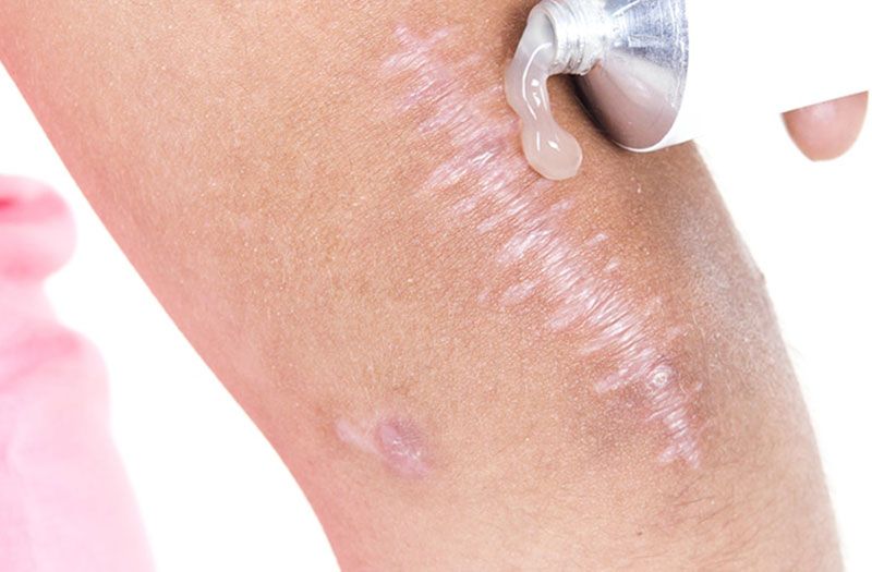 Nhau thai cừu có tác dụng gì? Uống nhau thai cừu bao lâu thì ngưng? 3