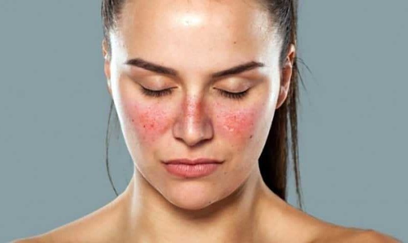 nhiem-nam-da-mat-co-nguy-hiem-khong 2.jpg