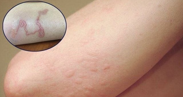 Nhiễm sán chó có nguy hiểm không? Hướng dẫn cách phòng ngừa 1