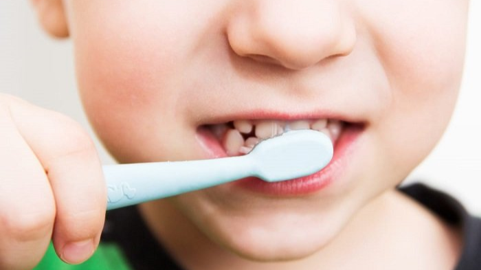 Nhiệt miệng ở trẻ em do nguyên nhân gì? Làm sao điều trị? 3