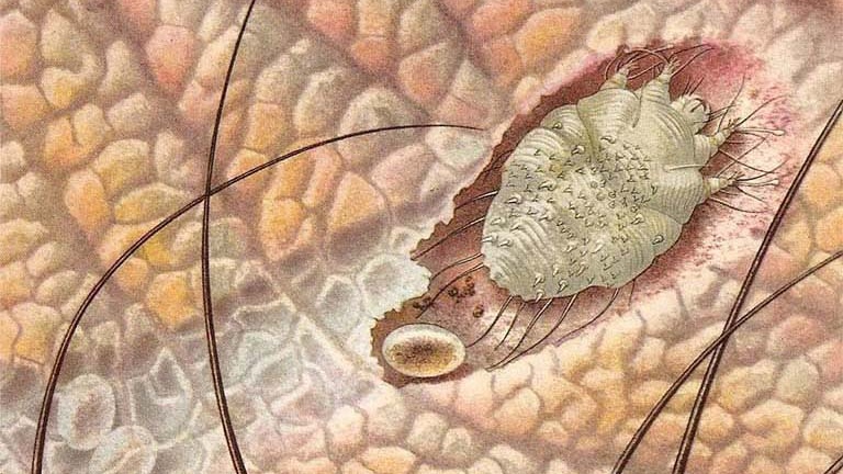 Những cây thuốc nam trị ghẻ ngứa trong dân gian có thể bạn chưa biết 2