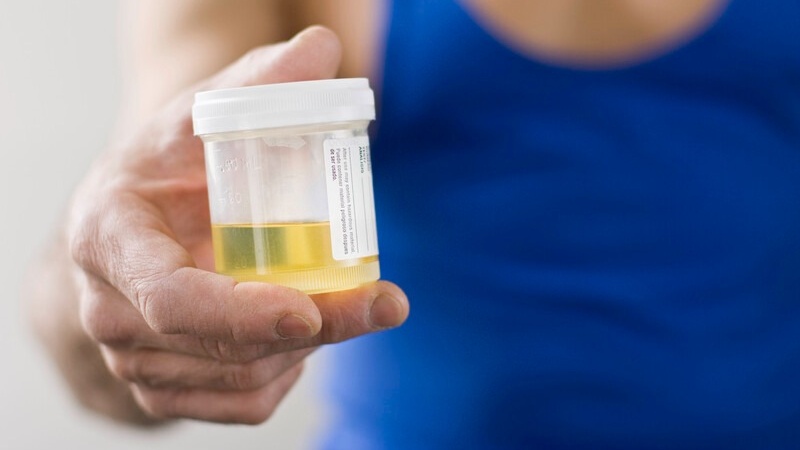 Những đặc điểm của nước tiểu bình thường bạn cần biết 1