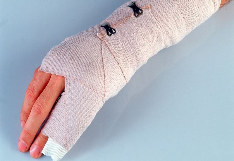 Những dấu hiệu biến chứng sau bó bột bạn không thể bỏ qua 1