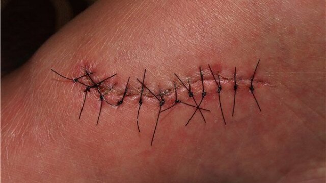 nhung-dieu-can-biet-ve-khau-vet-thuong 1.jpg