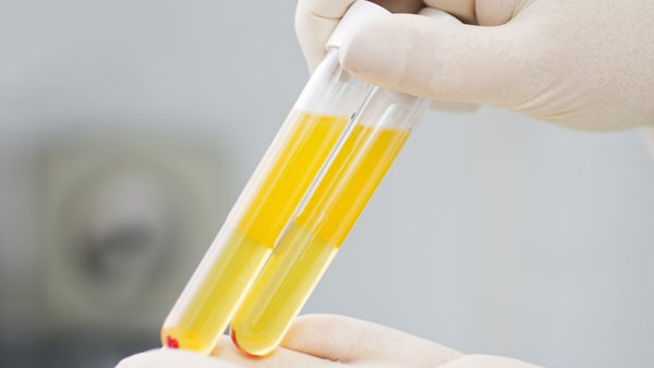 Những điều cần biết về liệu pháp huyết tương hồi phục 1