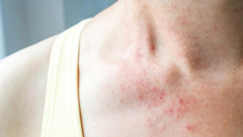 Những điều cần biết về liệu pháp huyết tương hồi phục 2