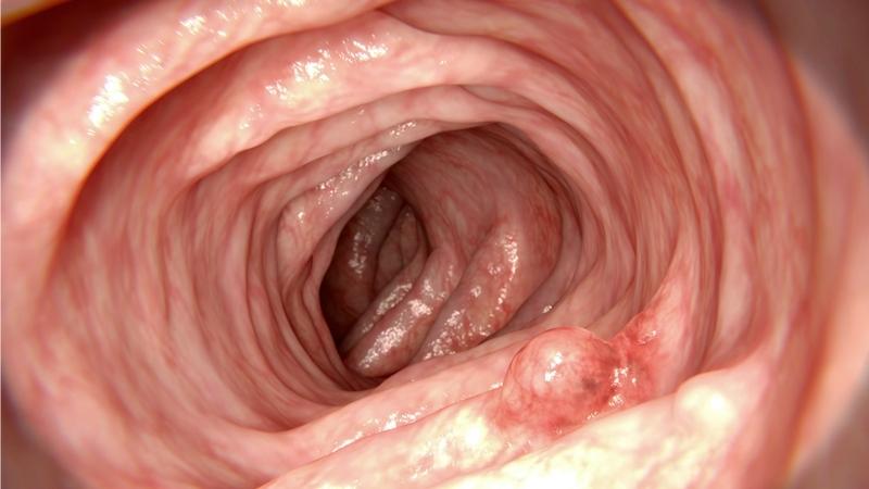 Những điều cần biết về phương pháp siêu âm nội soi 2