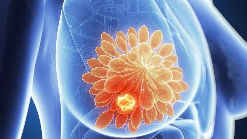 Những điều cần biết về phương pháp sinh thiết lỏng ctDNA 3