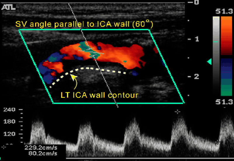 Siêu âm bụng cho trẻ em: Những điều cần biết3