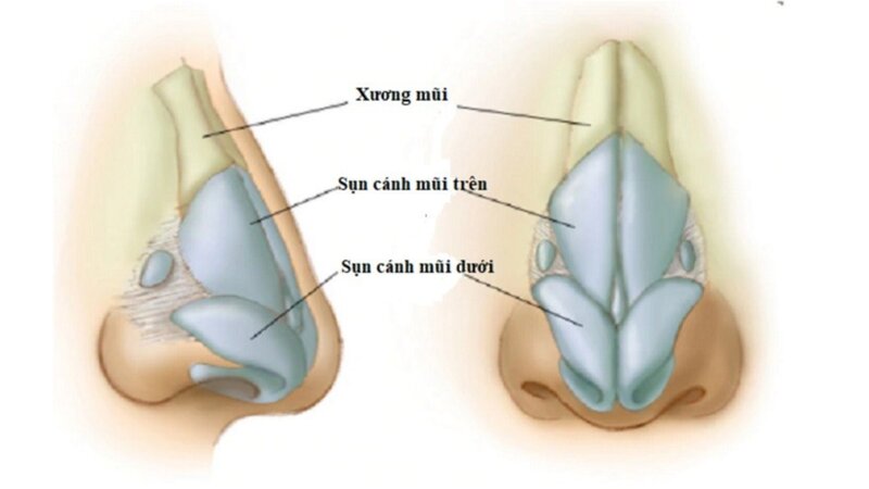 nhung-dieu-can-biet-ve-sun-va-nguyen-nhan-gay-ra-ton-thuong-sun-thuong-gap 2.jpg
