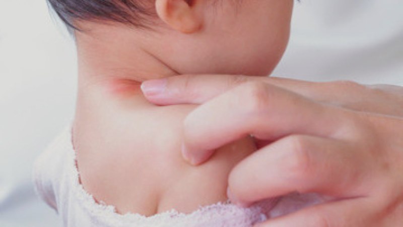 Những điều cần biết về tình trạng trẻ nổi hạch ở cổ lâu ngày 4