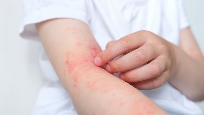 Những loại thuốc tiêm khớp và lưu ý khi sử dụng 4