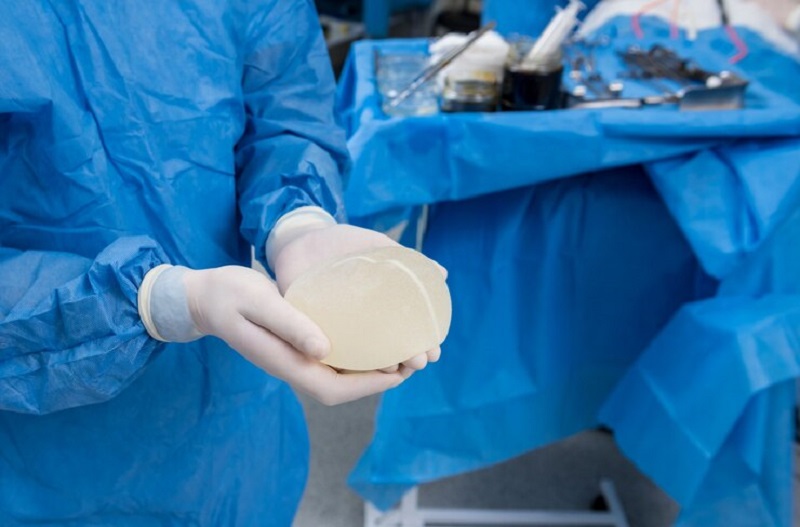 Những lưu ý cần biết trước khi phẫu thuật nâng ngực 3