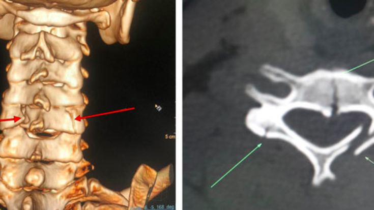 Những lưu ý khi chụp CT vùng cổ bạn nên biết 1