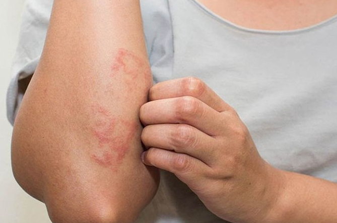 Những nguyên nhân gây ngứa ngứa chân tay về đêm 3