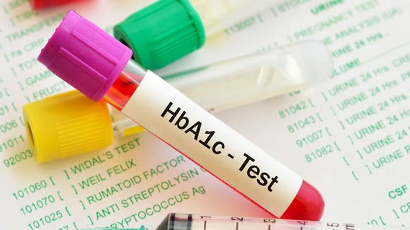 Tìm hiểu về thuốc làm giảm HbA1c ở bệnh nhân đái tháo đường 3