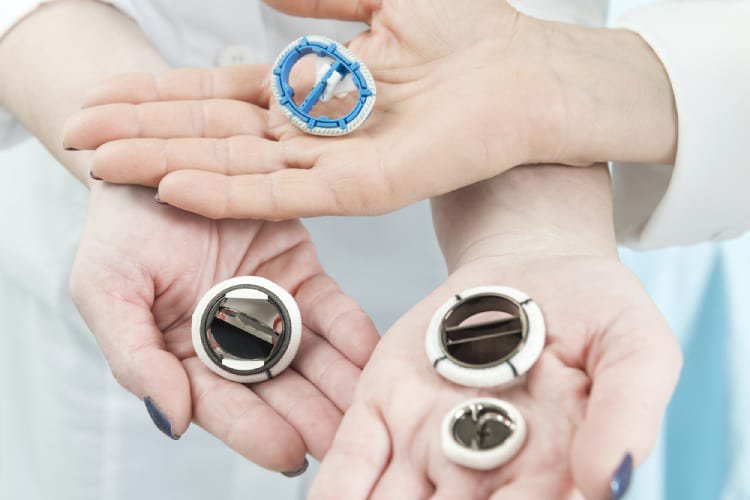 Những thông tin bạn cần biết về cách điều trị hở van tim 2 lá 2