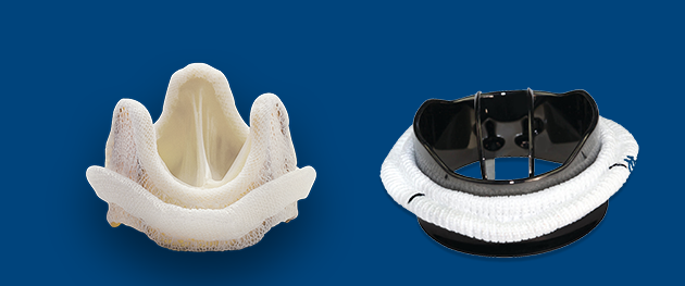 Những thông tin bạn cần biết về cách điều trị hở van tim 2 lá 3