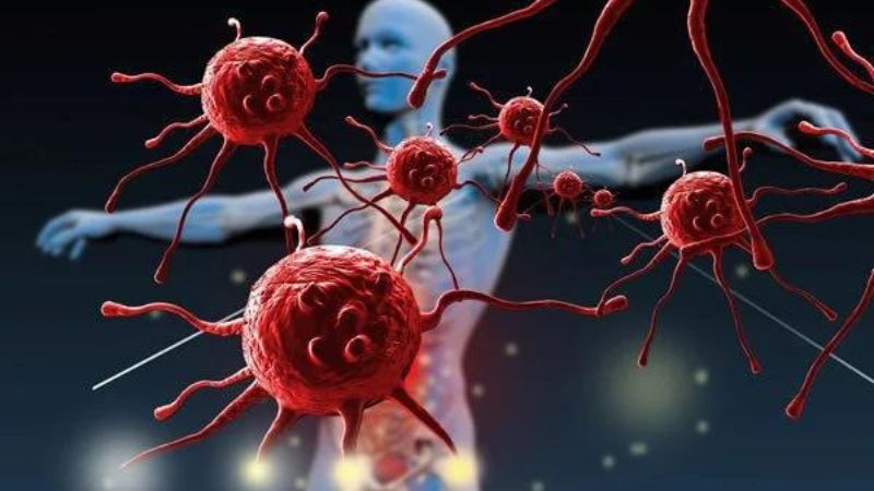 Những thông tin cần biết về bệnh U lympho Burkitt 3