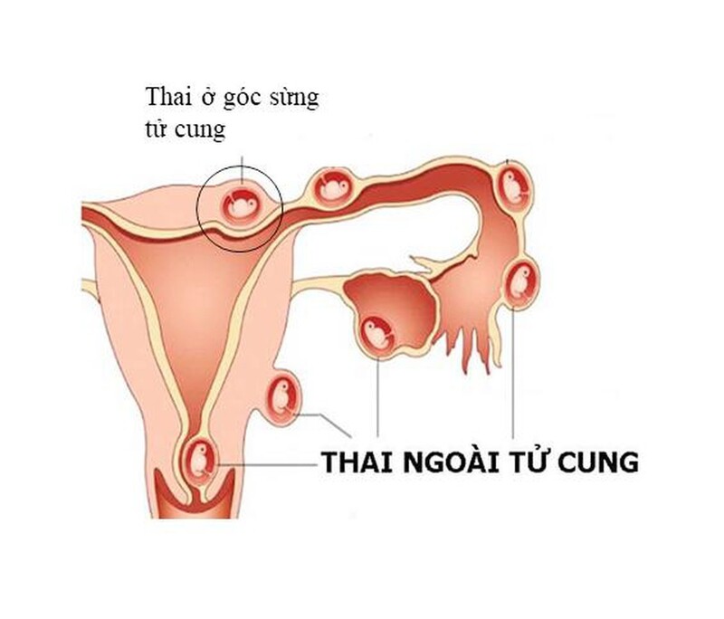 Những thông tin cần biết về kết quả xét nghiệm máu có thai 4