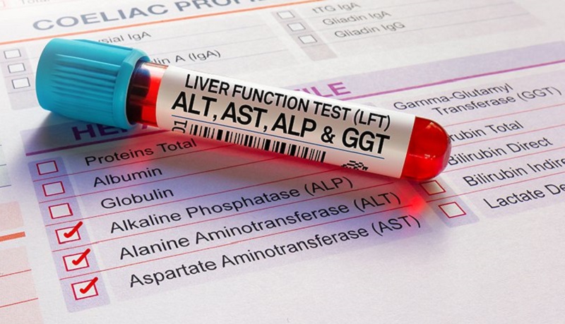 Những thông tin cần biết: Xét nghiệm máu tổng quát biết được những bệnh gì? 2