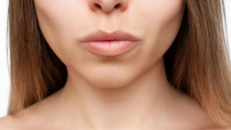 Niềng răng bị gò má cao phải làm sao? Khắc phục như thế nào? 3