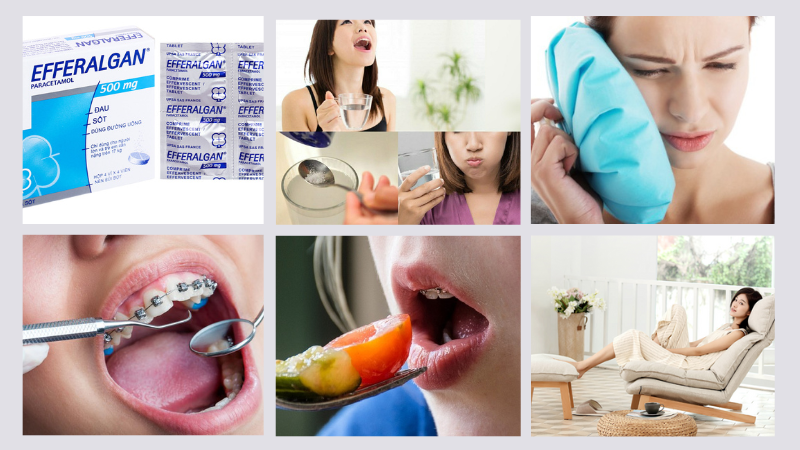 Niềng răng bị mỏi hàm: Nguyên nhân và cách khắc phục nhanh nhất 4