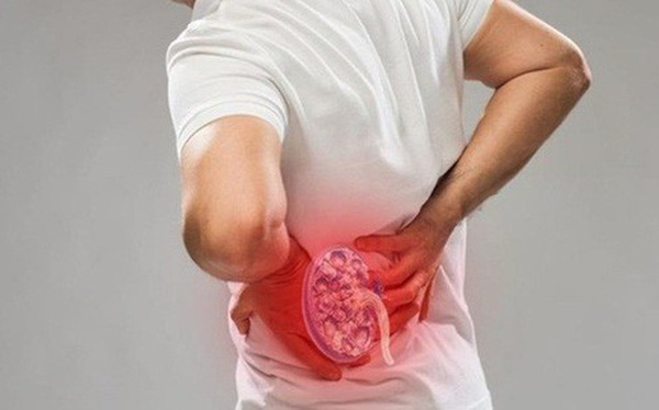 Cách nhận biết điểm đau niệu quản 3