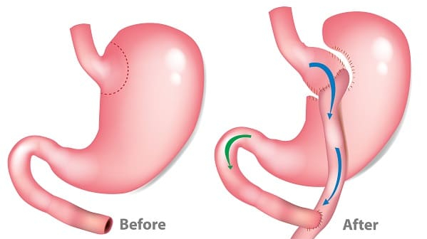 noi-tat-da-day-noi-soi-trong-giam-can 2.jpg