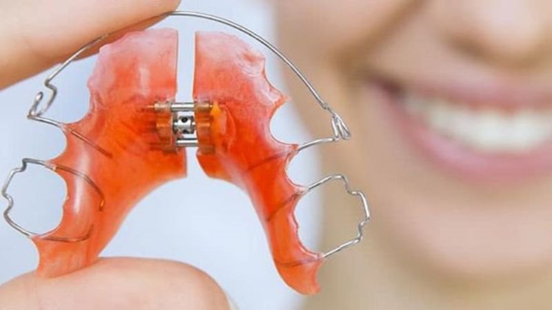 Nong hàm là gì? Khi nào cần thực hiện? 1