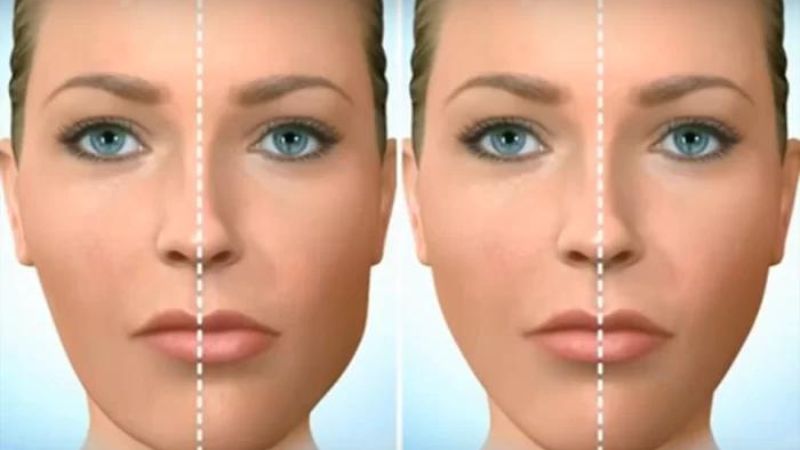 Nong hàm là gì? Khi nào cần thực hiện? 4