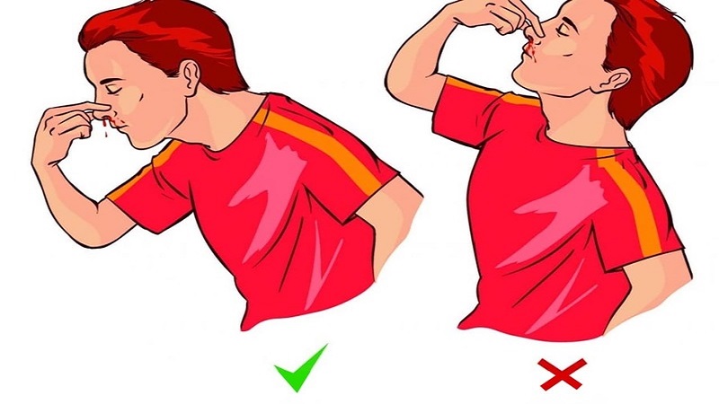 Nóng trong chảy máu cam: Nguyên nhân, cách ngăn ngừa và xử trí 4
