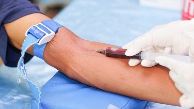 nrbc-trong-xet-nghiem-mau-la-gi-y-nghia-cua-chi-so-nrbc 4