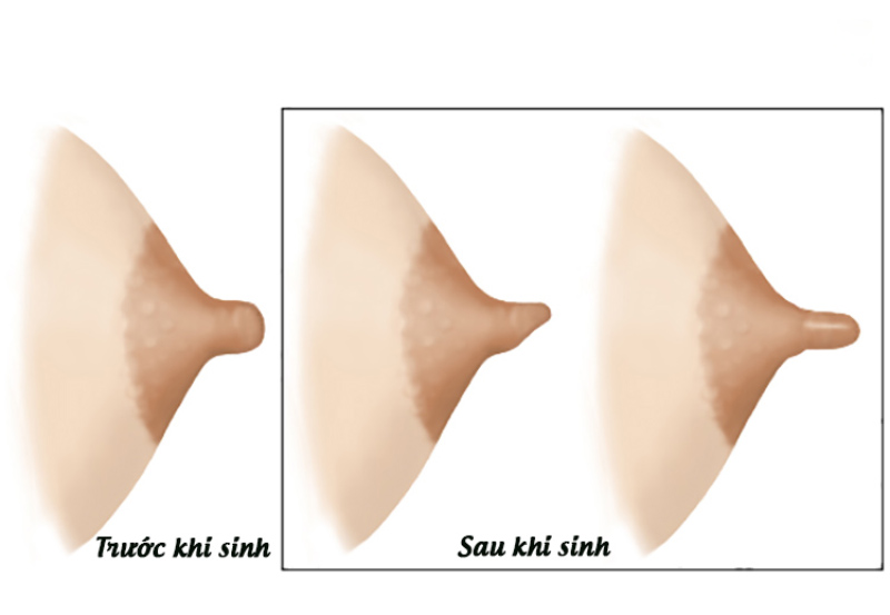 Núm vú và những vấn đề thường gặp 4