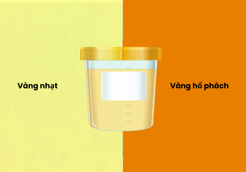 Nước tiểu màu vàng chanh​ có bình thường không? 2
