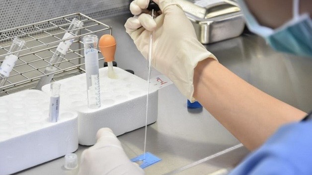 loc-rua-tinh-trung-va-nhung-dieu-can-biet 2