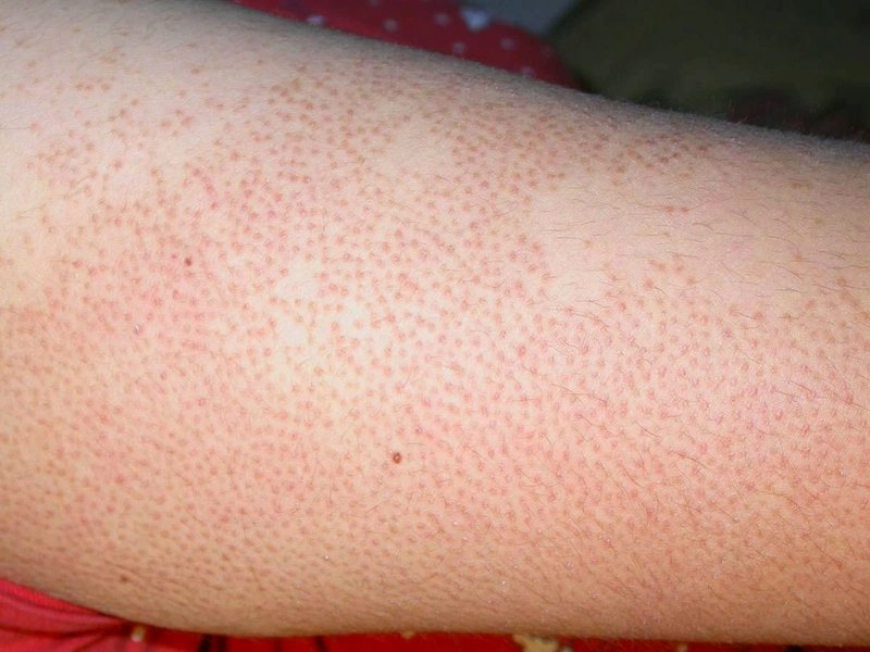 paracetamol-tri-benh-gi-nhung-dieu-luu-y-khi-su-dung-paracetamol 3.jpg