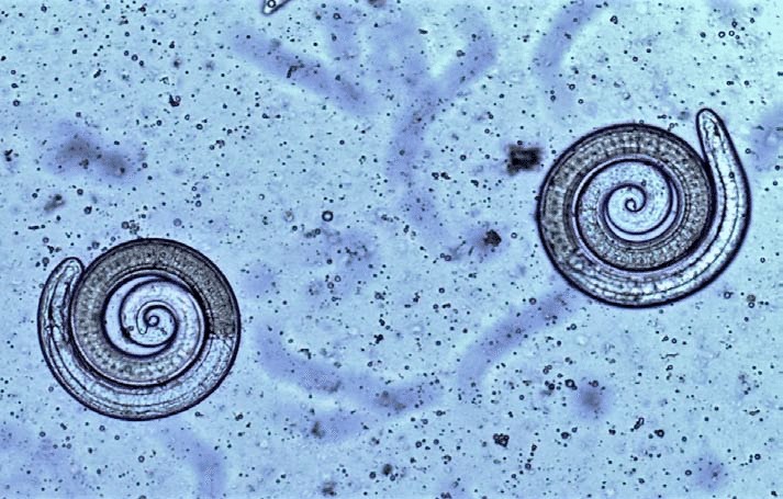 phac-do-dieu-tri-benh-giun-xoan-hien-nay 1.jpg