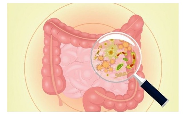 phac-do-dieu-tri-benh-giun-xoan-hien-nay 2.jpg