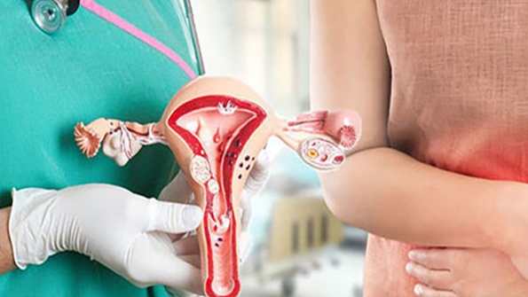 Phác đồ điều trị viêm lộ tuyến cổ tử cung như thế nào? 1