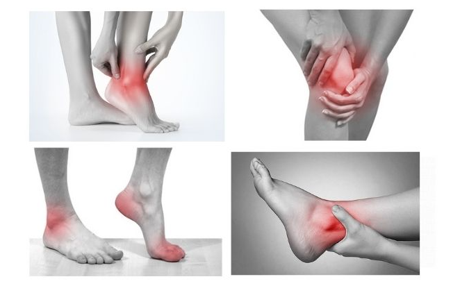 phan-biet-benh-viem-khop-dang-thap-va-viem-khop-vay-nen 3.png