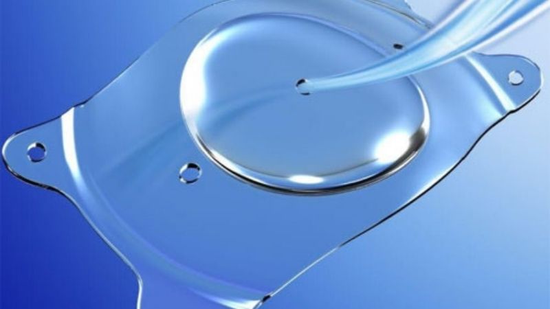 Phẫu thuật ICL là gì và quy trình thực hiện 1