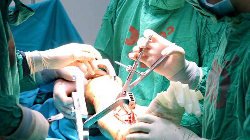 Phẫu thuật thay toàn bộ xương cánh tay áp dụng điều trị bệnh gì? Ưu và nhược điểm của phương pháp này 5