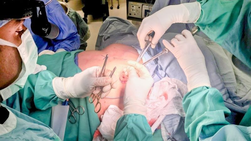 Phẫu thuật tổng quát là gì và khám ở đâu uy tín 3