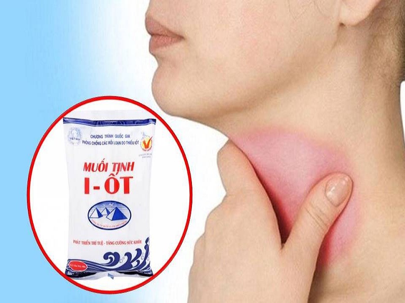 Phình tuyến giáp nên ăn gì? 2