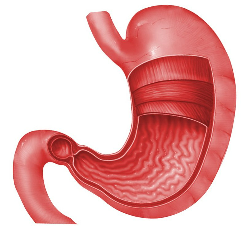 Phình vị dạ dày và một số bệnh lý thường gặp1